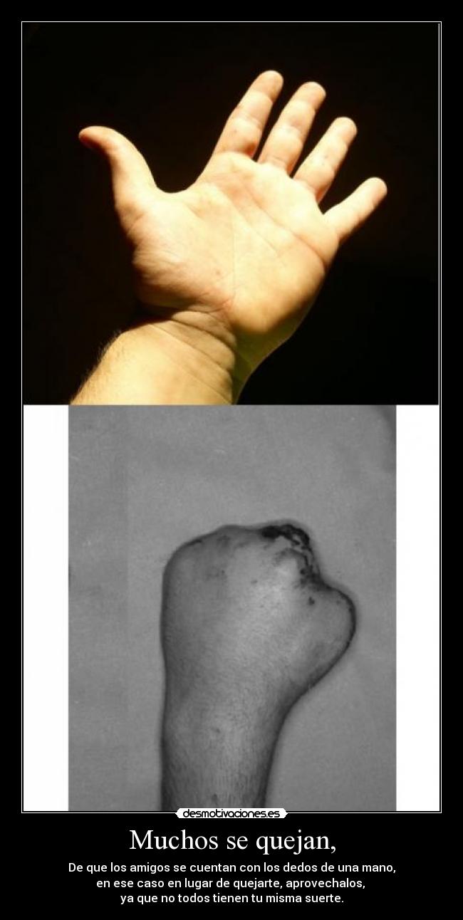 Muchos se quejan, - 