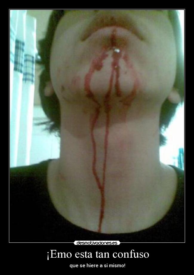 ¡Emo esta tan confuso -