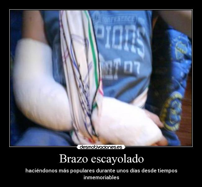 Brazo escayolado -