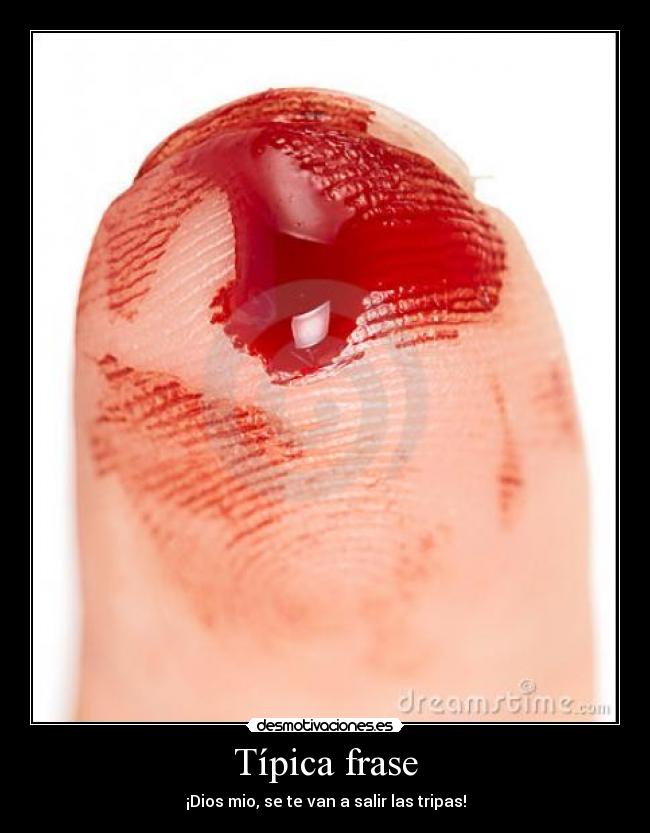 Típica frase - 
