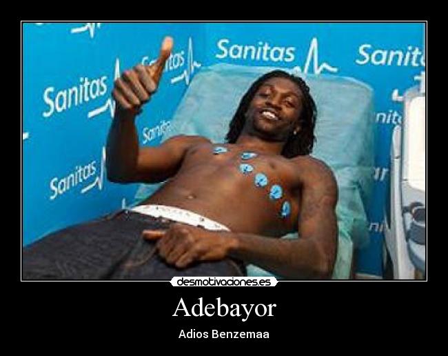 Adebayor -
