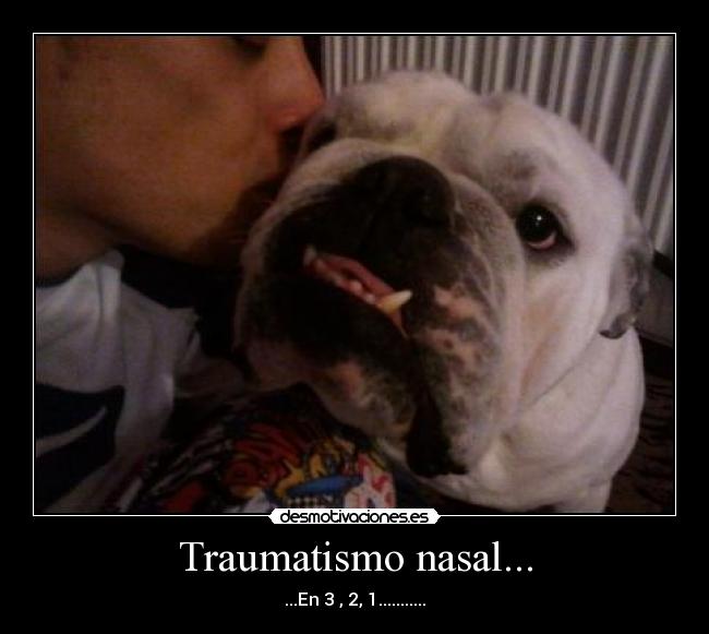 Traumatismo nasal... -