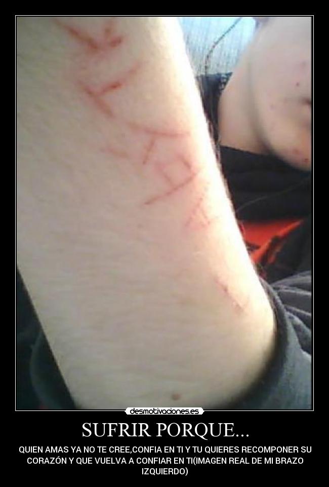 SUFRIR PORQUE... -