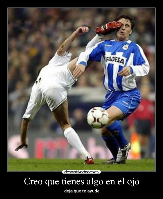 Creo que tienes algo en el ojo -