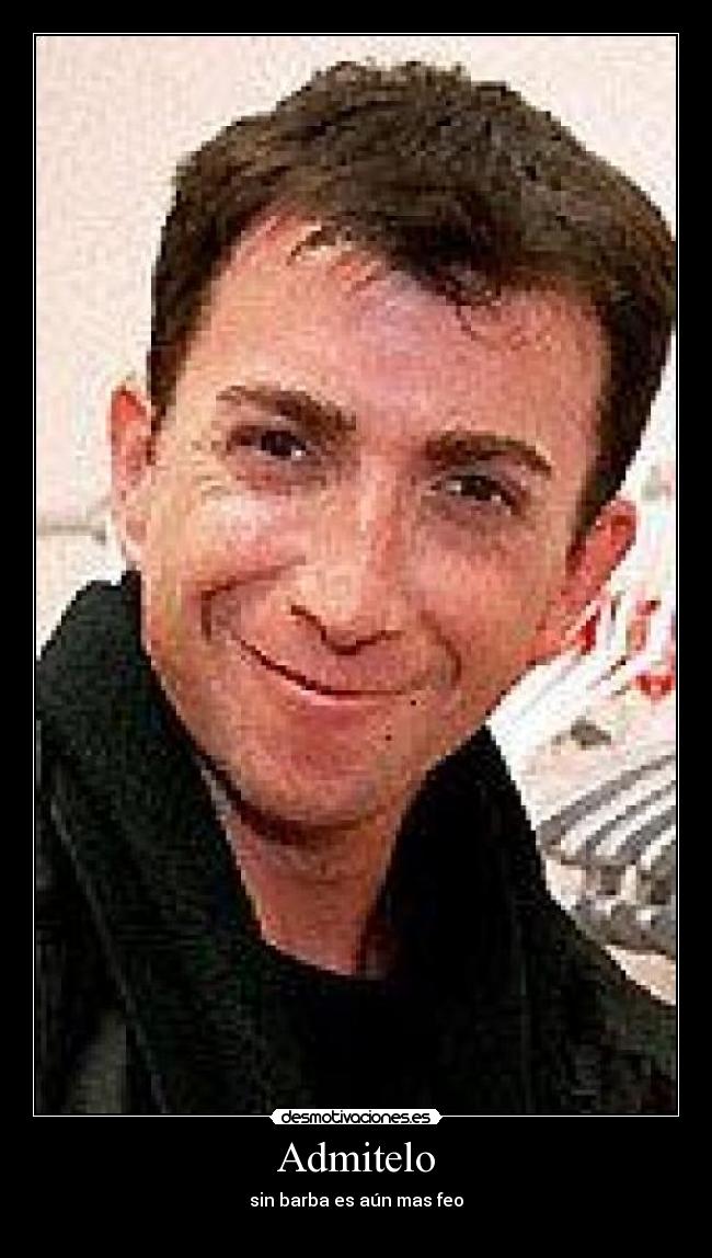 Admitelo - sin barba es aún mas feo
