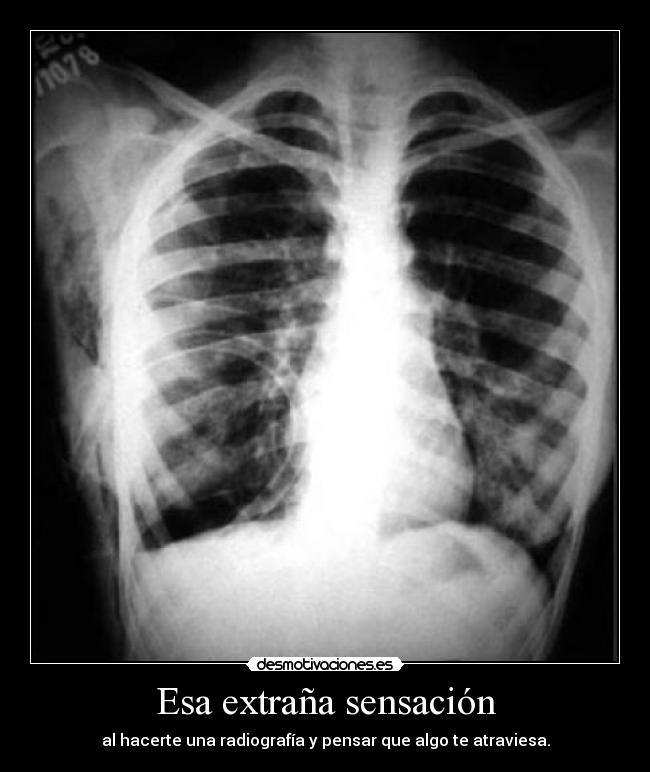 Esa extraña sensación - 