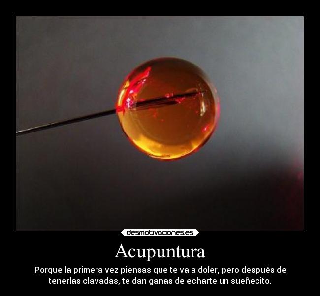 Acupuntura -