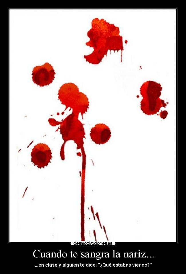 Cuando te sangra la nariz... - ...en clase y alguien te dice: ¿Qué estabas viendo?