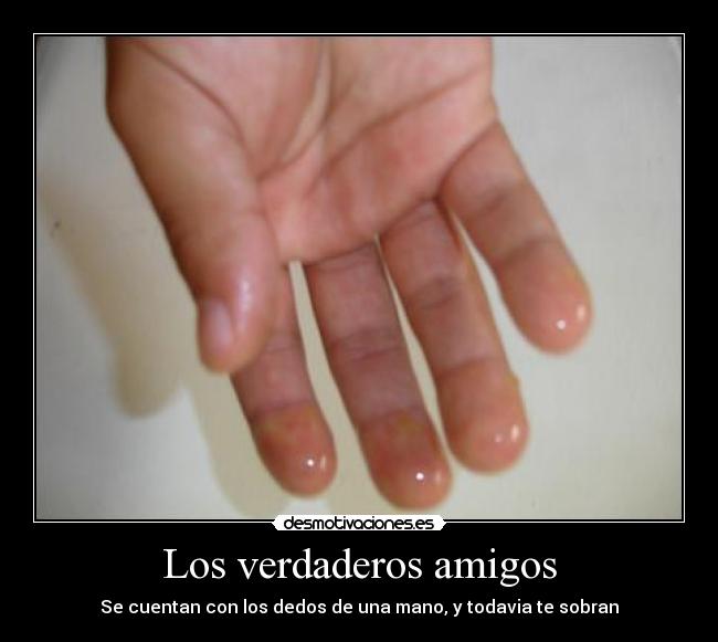 Los verdaderos amigos -