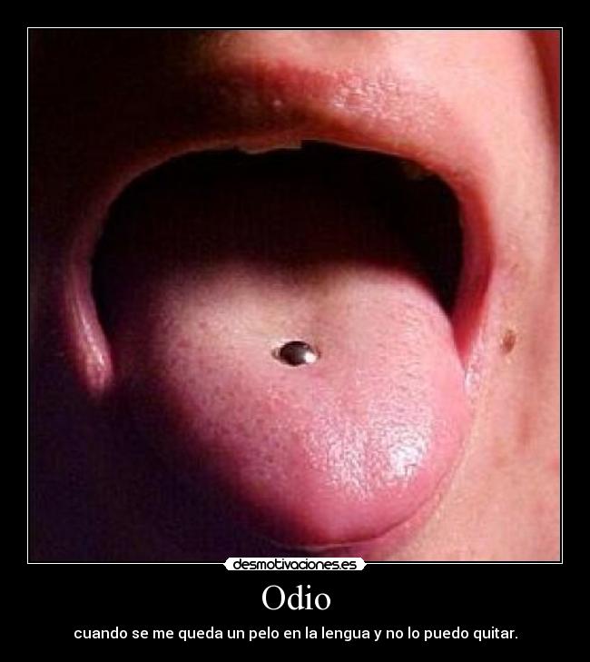Odio -