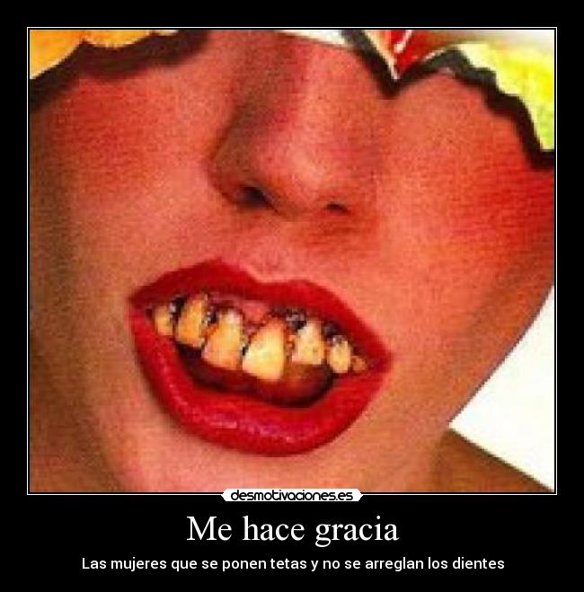 Me hace gracia - Las mujeres que se ponen tetas y no se arreglan los dientes