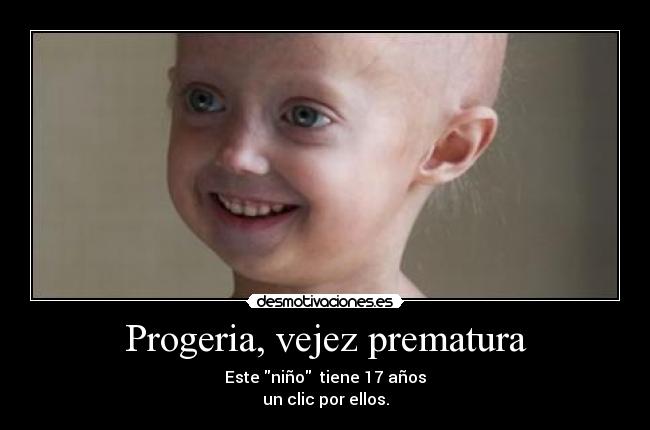 carteles progeria desmotivaciones