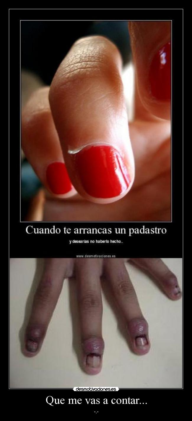 Que me vas a contar... - -.-