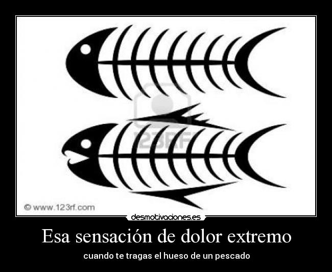 carteles dolor eso desmotivaciones