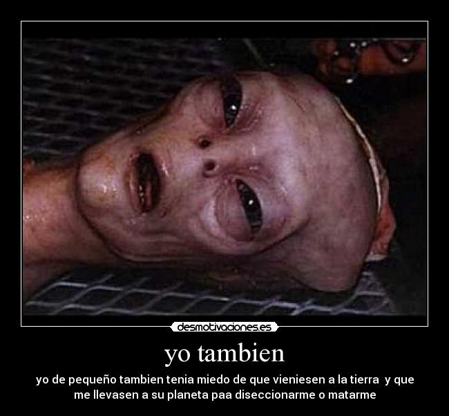 yo tambien -