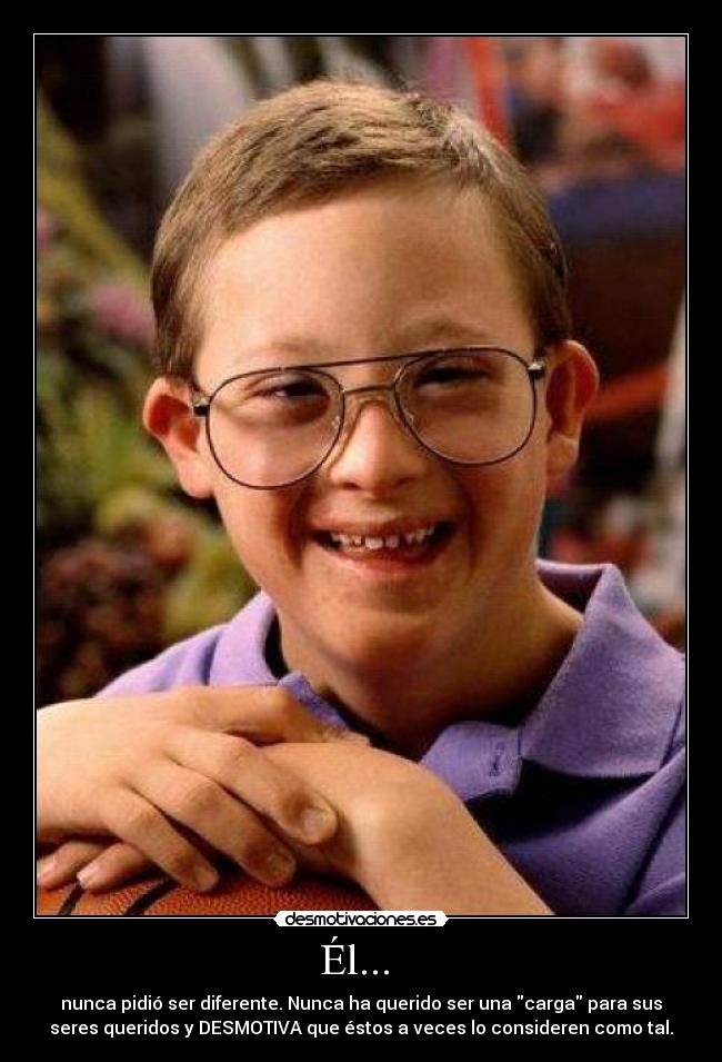 Él... - nunca pidió ser diferente. Nunca ha querido ser una carga para sus
seres queridos y DESMOTIVA que éstos a veces lo consideren como tal.