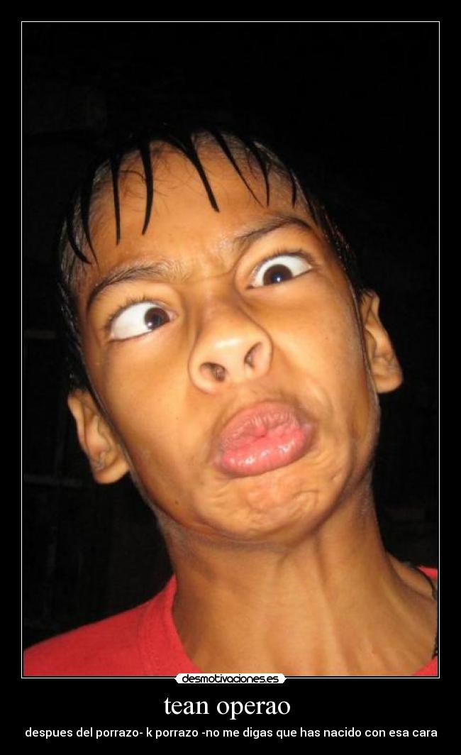 tean operao - despues del porrazo- k porrazo -no me digas que has nacido con esa cara