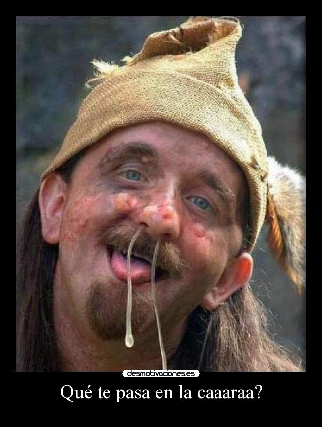 Qué te pasa en la caaaraa? -