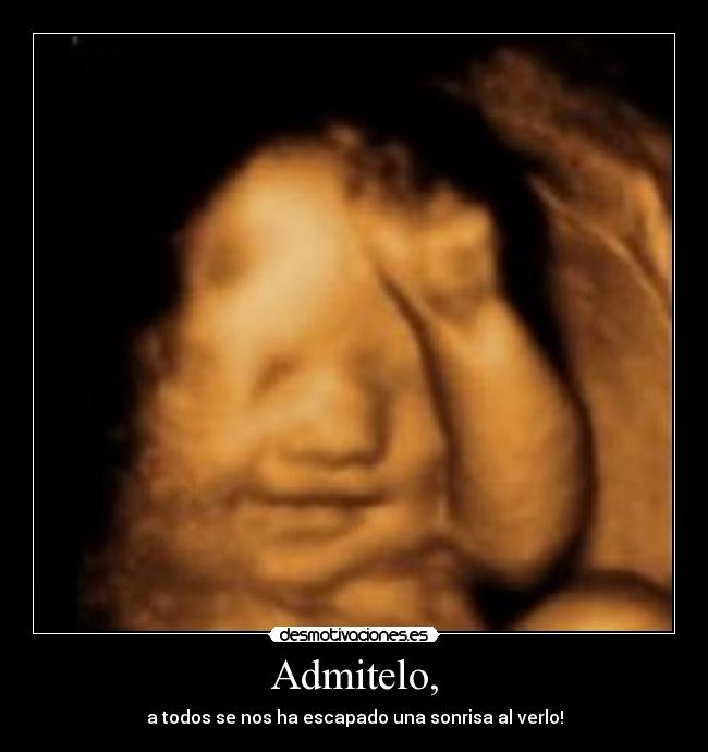 Admitelo, - a todos se nos ha escapado una sonrisa al verlo!