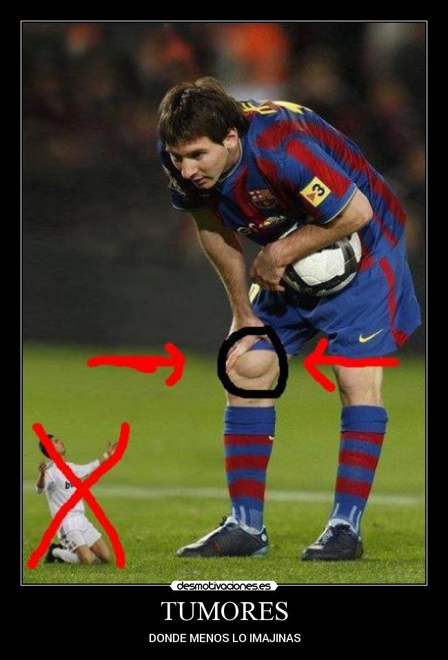 TUMORES - DONDE MENOS LO IMAJINAS