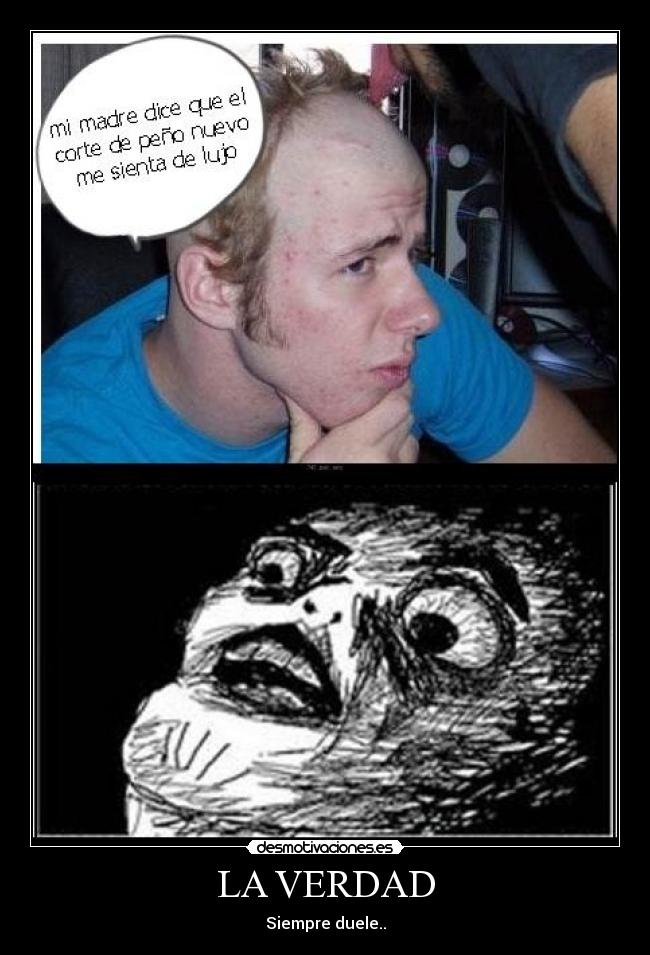 LA VERDAD - Siempre duele..