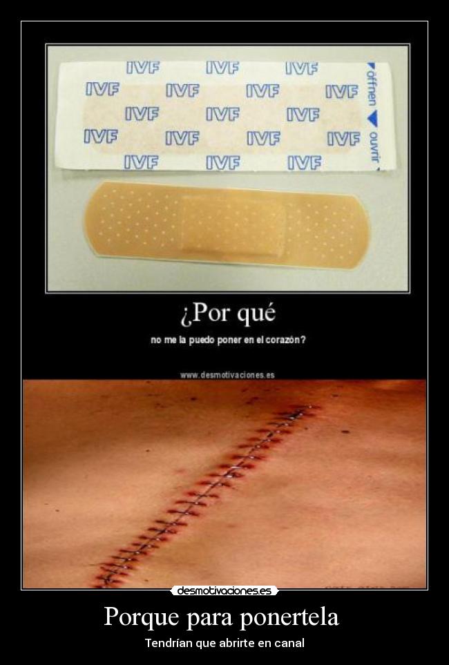 Porque para ponertela -