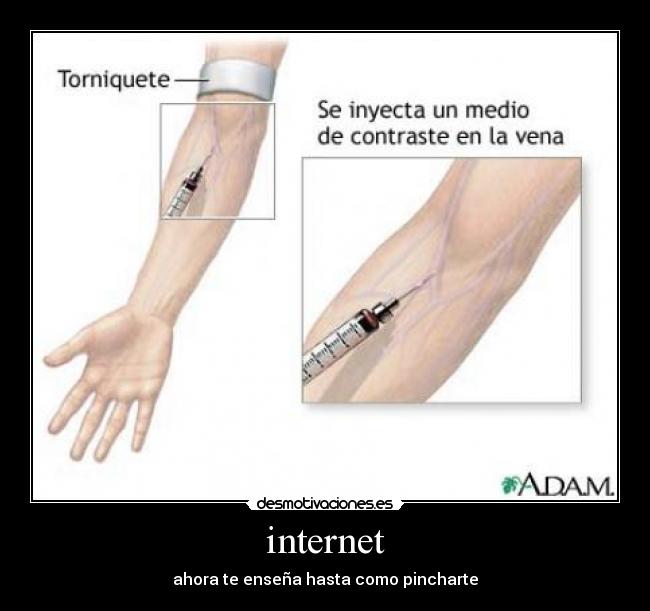 internet - ahora te enseña hasta como pincharte