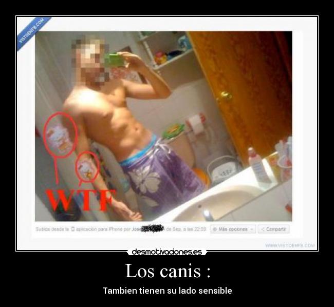 Los canis : - Tambien tienen su lado sensible