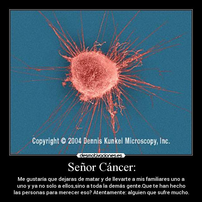 Señor Cáncer: - Me gustaría que dejaras de matar y de llevarte a mis familiares uno a
uno y ya no solo a ellos,sino a toda la demás gente.Que te han hecho
las personas para merecer eso? Atentamente: alguien que sufre mucho.