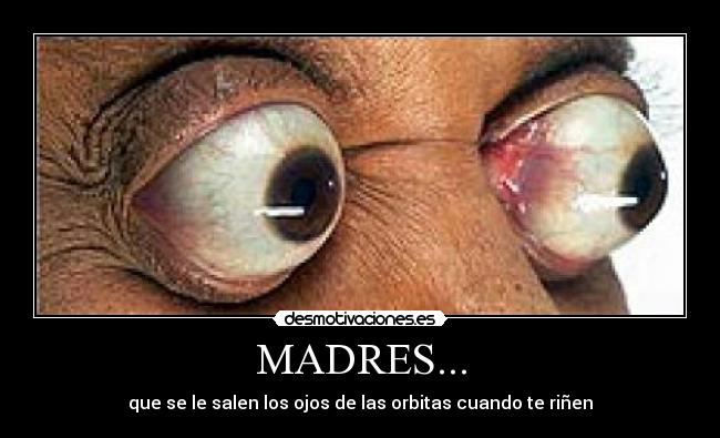 MADRES... - que se le salen los ojos de las orbitas cuando te riñen