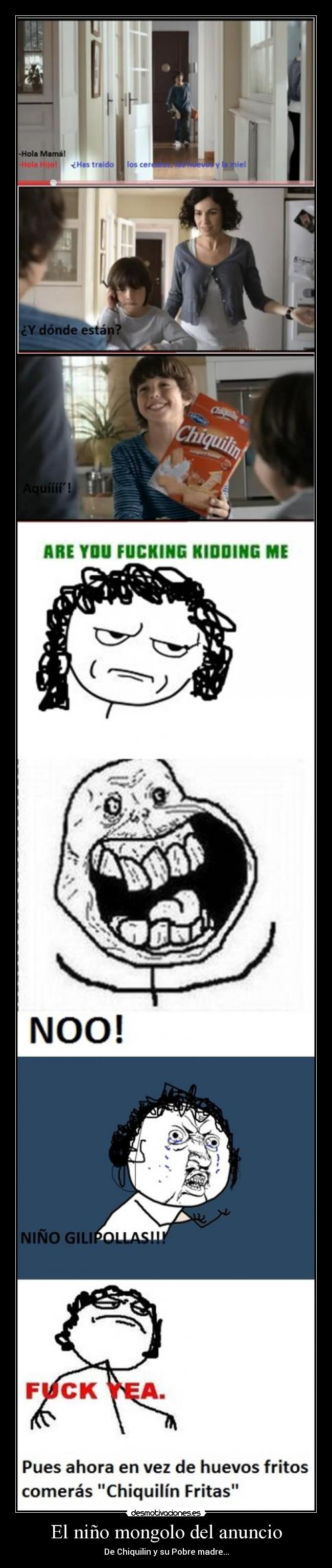 El niño mongolo del anuncio -