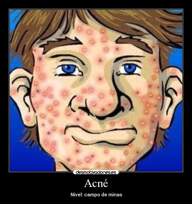 carteles stiwi99 desmotivaciones