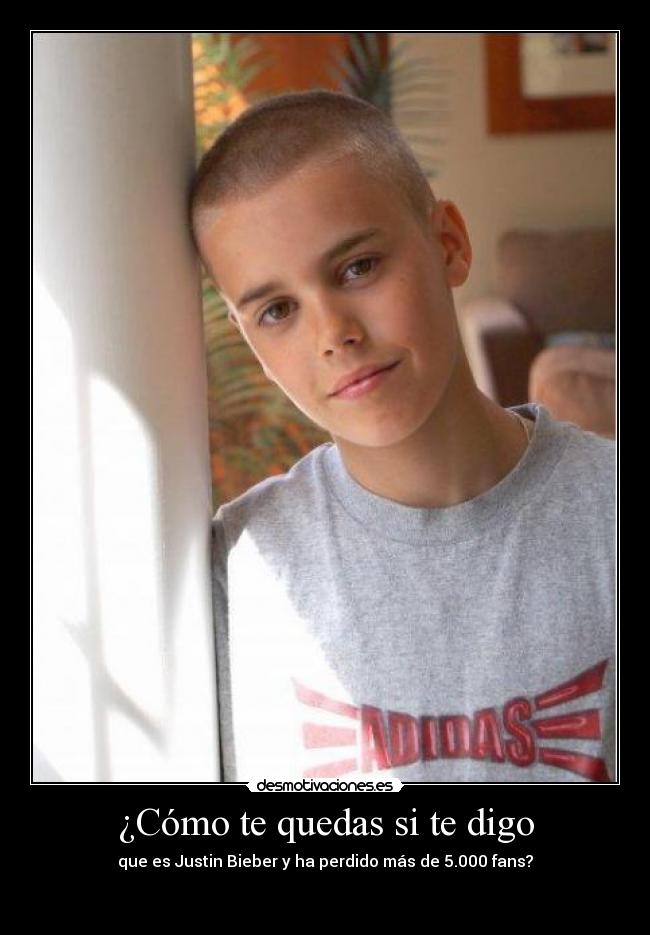 ¿Cómo te quedas si te digo - que es Justin Bieber y ha perdido más de 5.000 fans?