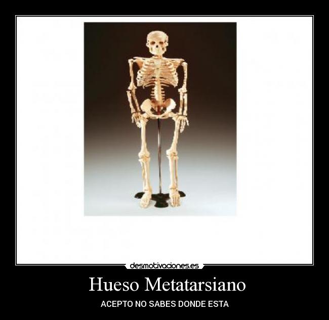 Hueso Metatarsiano -