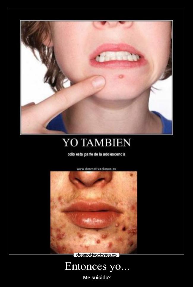 Entonces yo... - Me suicido?