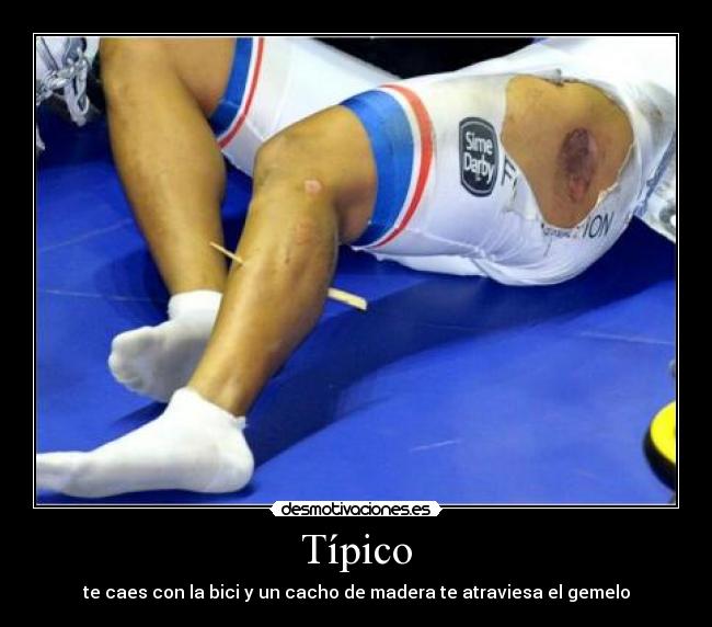 Típico - te caes con la bici y un cacho de madera te atraviesa el gemelo