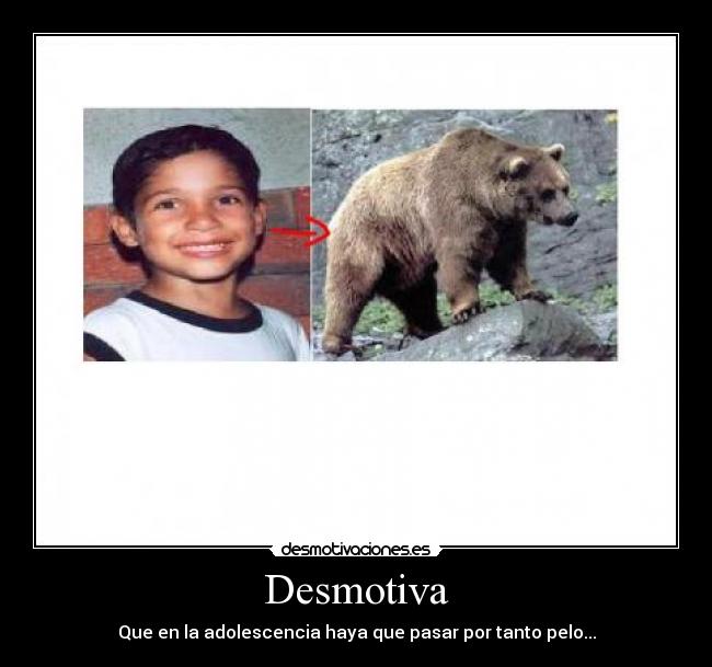 Desmotiva - Que en la adolescencia haya que pasar por tanto pelo...