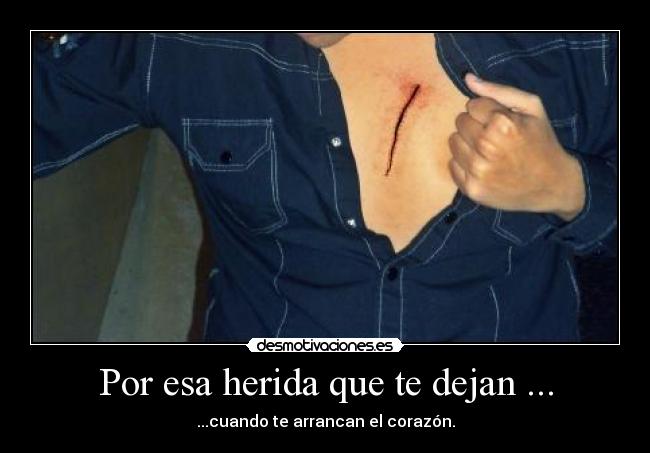Por esa herida que te dejan ... - ...cuando te arrancan el corazón.
