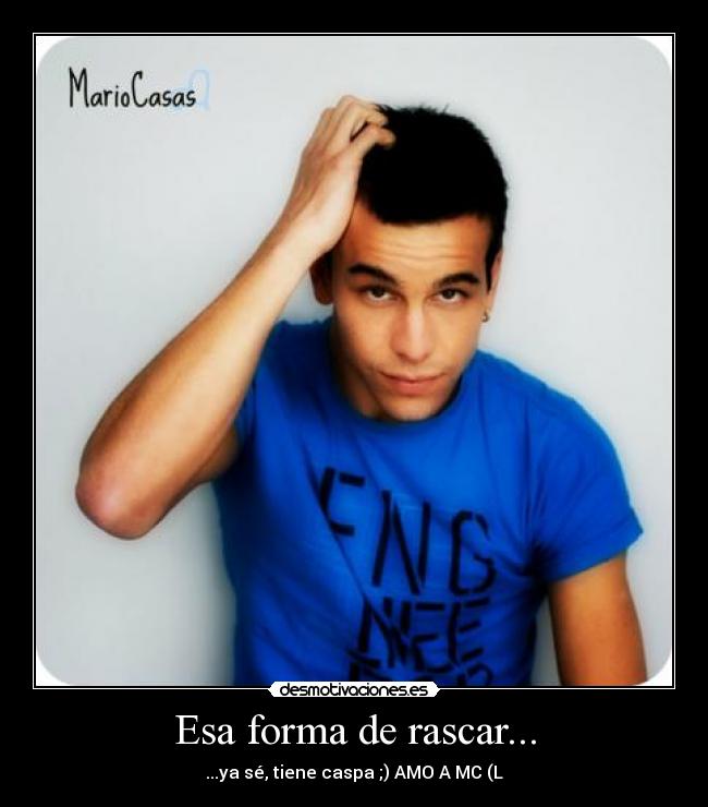 Esa forma de rascar... - 