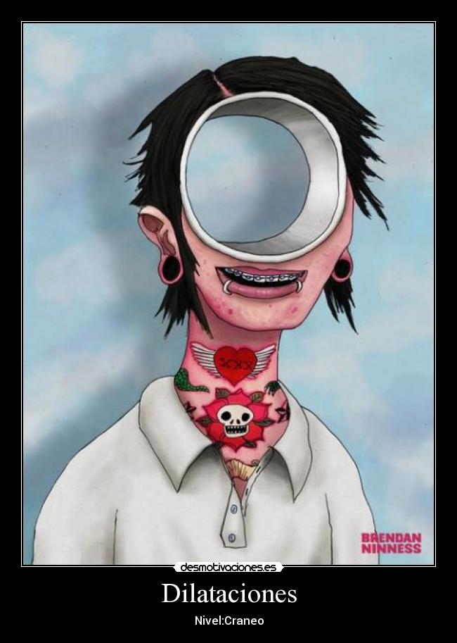 Dilataciones - Nivel:Craneo