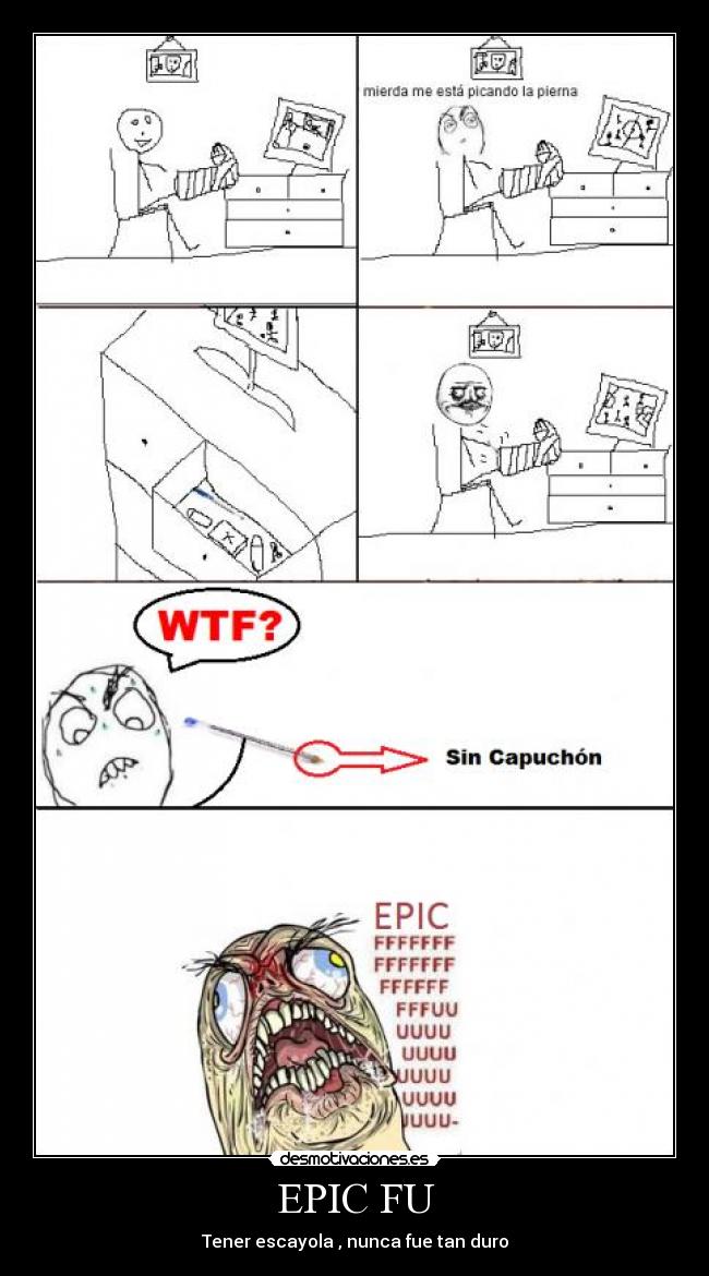 EPIC FU - Tener escayola , nunca fue tan duro