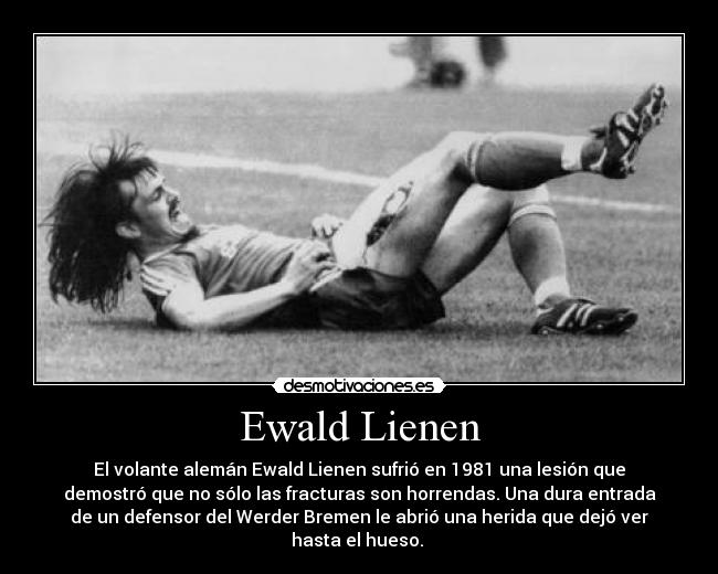 Ewald Lienen - El volante alemán Ewald Lienen sufrió en 1981 una lesión que
demostró que no sólo las fracturas son horrendas. Una dura entrada
de un defensor del Werder Bremen le abrió una herida que dejó ver
hasta el hueso. 