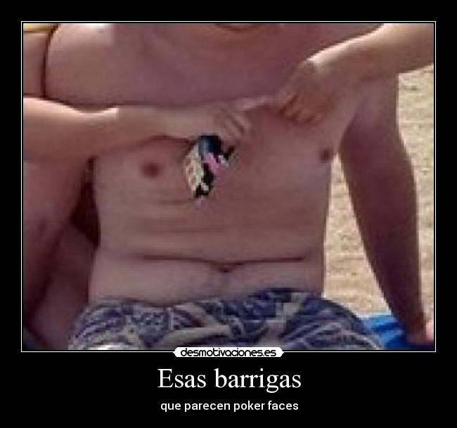 Esas barrigas - 