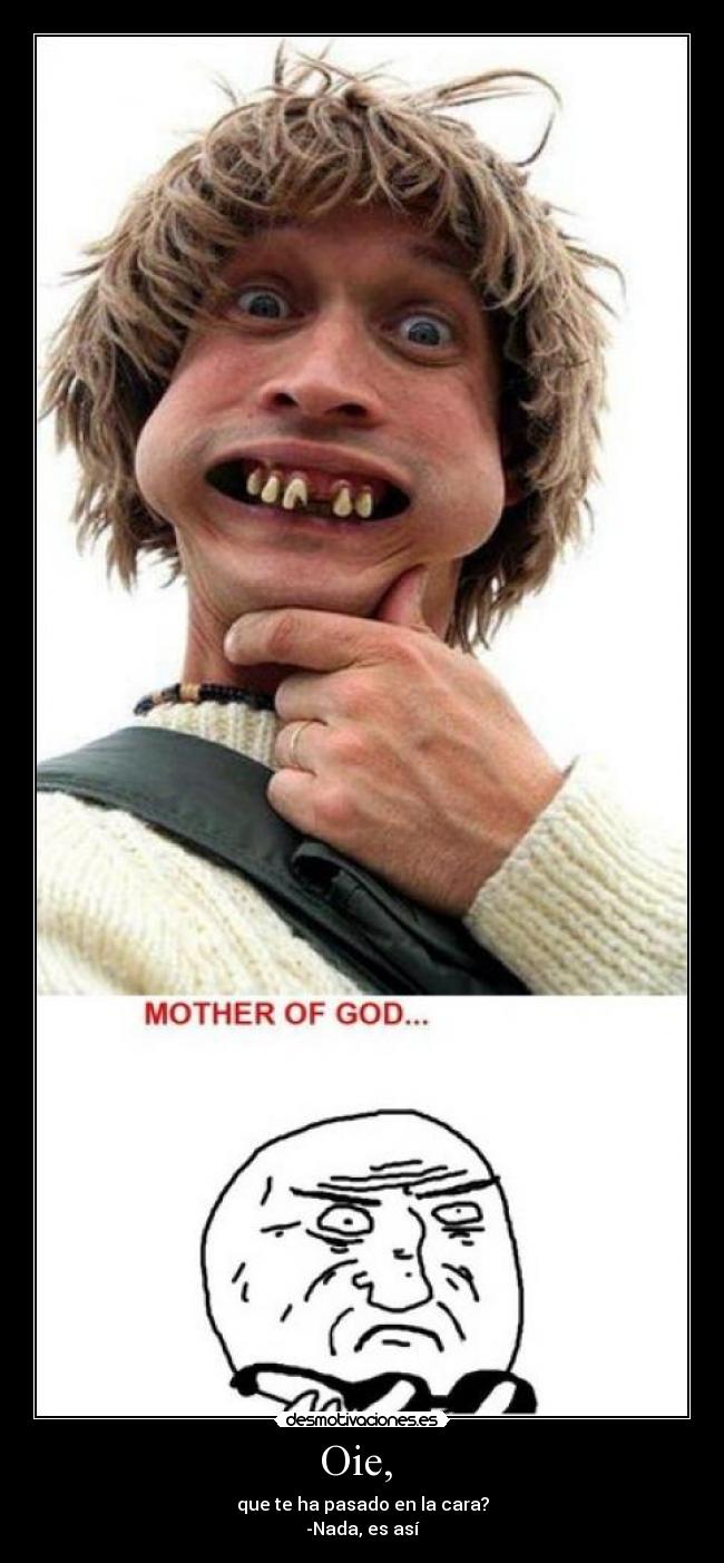 Oie, - que te ha pasado en la cara?
-Nada, es así