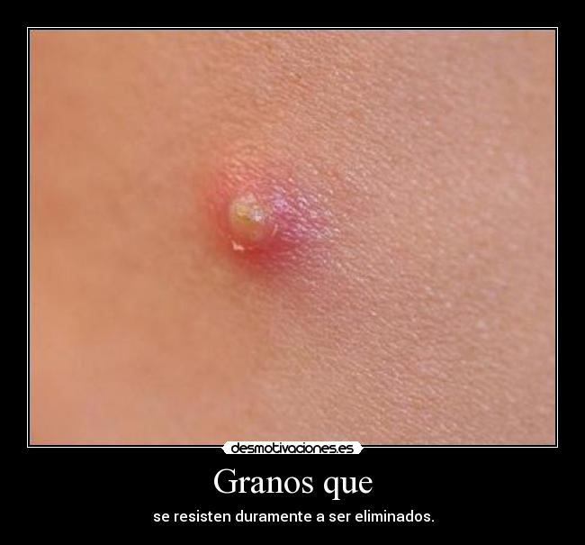 Granos que -