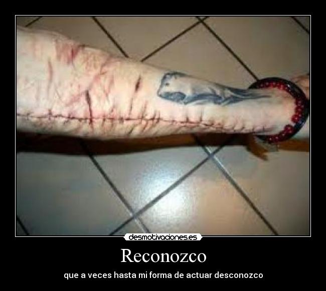 Reconozco - 