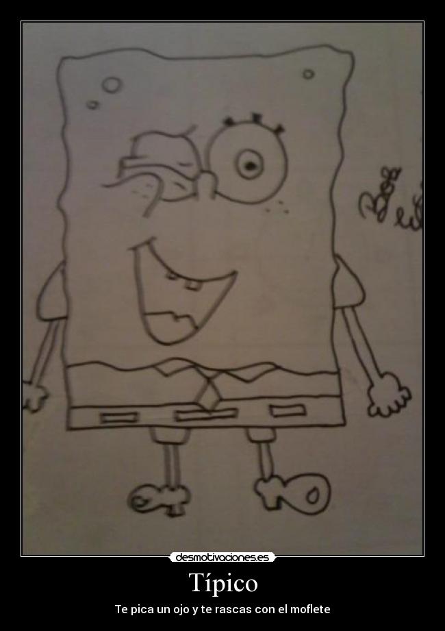 Típico - Te pica un ojo y te rascas con el moflete