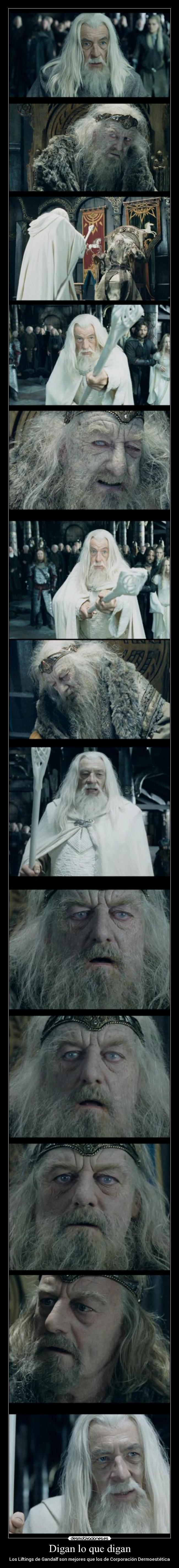 Digan lo que digan - Los Liftings de Gandalf son mejores que los de Corporación Dermoestética
