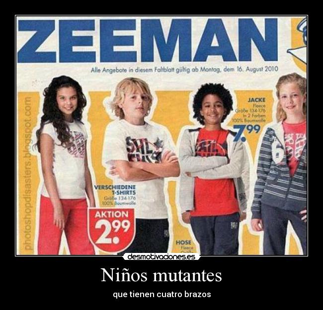 Niños mutantes - que tienen cuatro brazos