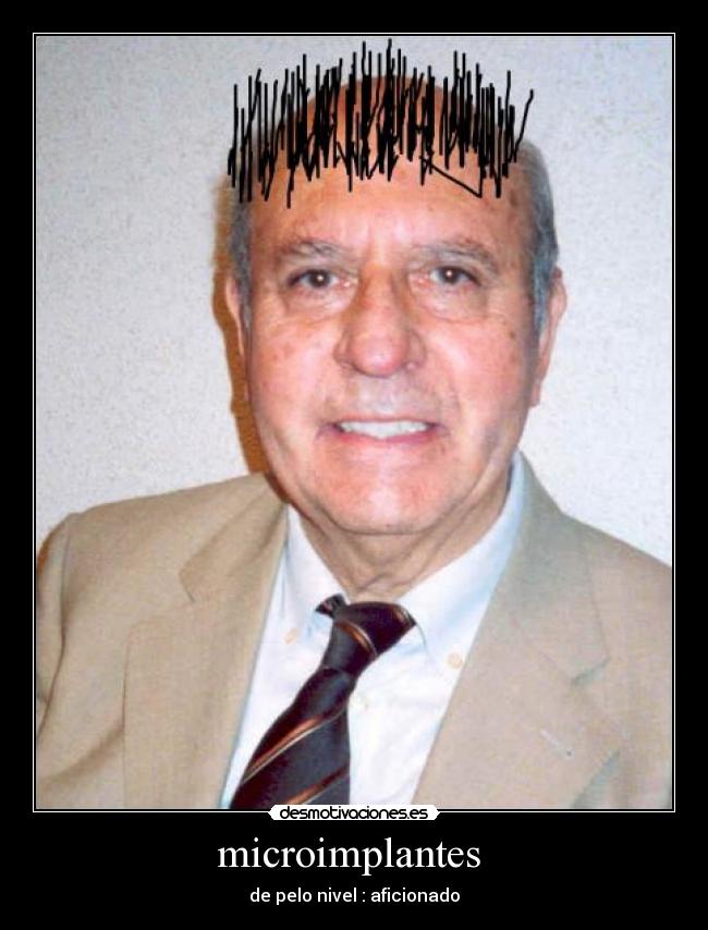 microimplantes  - 